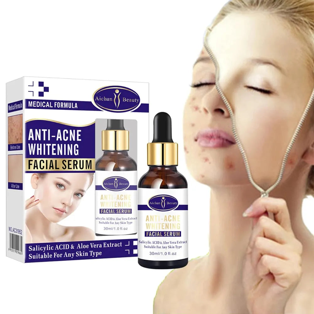 Aichun Beauty Anti Acne Facial Serum