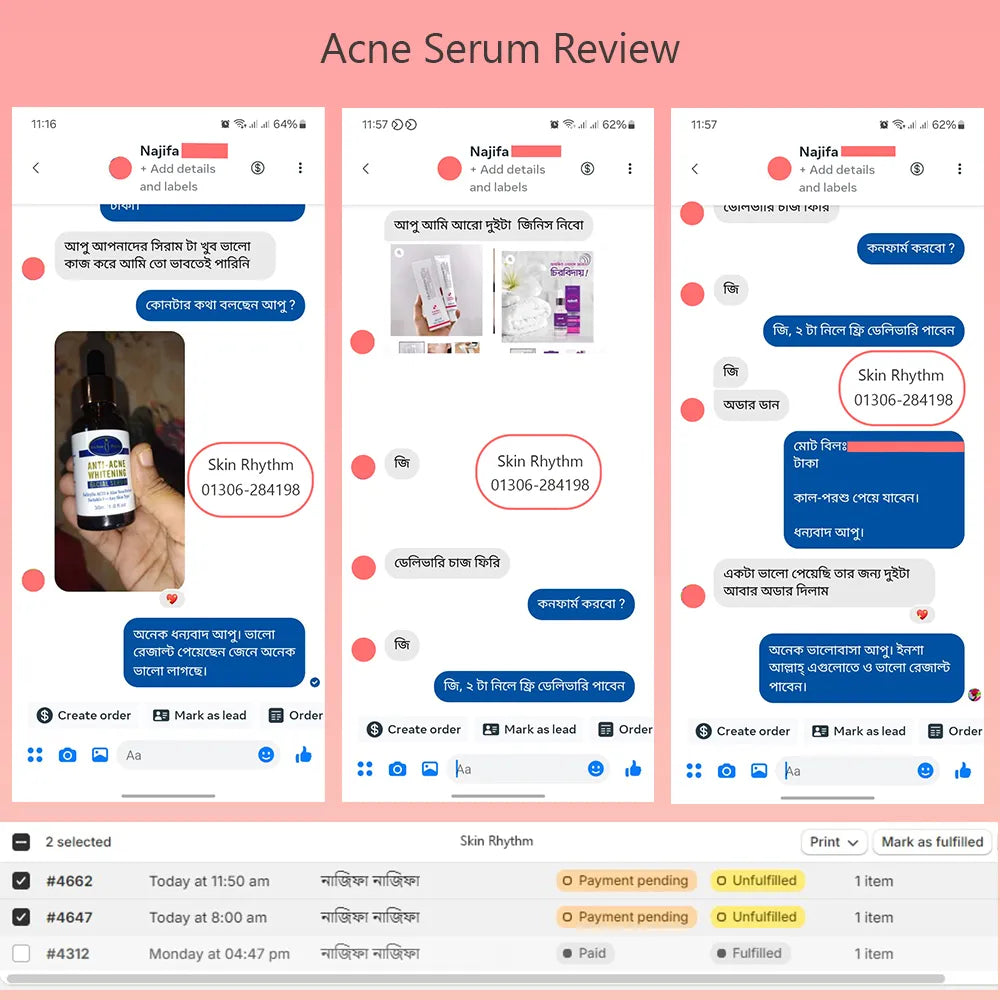 Aichun Beauty Anti Acne Facial Serum