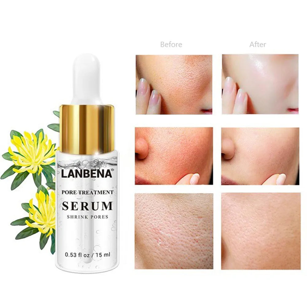 Lanbena Pore Treatment Serum