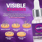Episoft Hair Inhibitor Serum