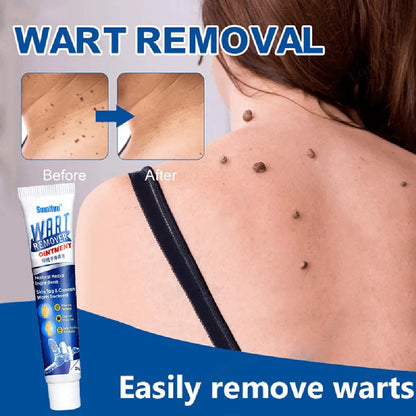 Sumifun Wart Remover Ointment